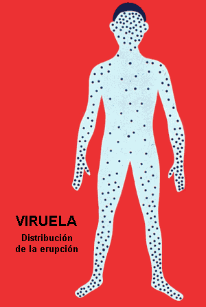 diseminación viruela