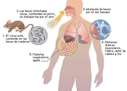 contagio hantavirus